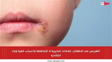 الهربس عند الأطفال: علامات تحذيرية لا تتجاهلها وأسباب خفية وراء انتشاره
